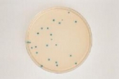 Abb. zeigt TBX-Agar mit blau-grünen E. coli-Kolonien (aus Merck-Manual)