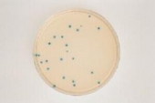 Abb. zeigt TBX-Agar mit blau-grnen E. coli-Kolonien (aus Merck-Manual)