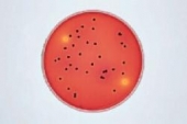 Abb. zeigt Salmonella typhimurium (schwarze Kol.) und Citrobacter freundii auf XLT4-Agar - aus Merck-Manual