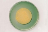 Abb. zeigt E. coli auf Membranfilter (aus Merck-Manual)