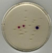 Abb. zeigt eine Mischung aus E. coli (violett), Citrobacter (rot) und Salmonella (farblos)