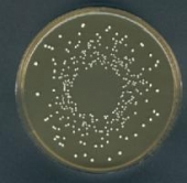 Abb. zeigt Lactobacillus casei auf MRS-Agar (aus Merck-Manual)