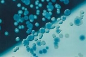 Abb.: E.coli (blau) und Serratia marcescens (farblos) (aus Merck Manual)