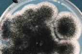 Abb. zeigt Aspergillus niger auf PDA (aus Merck-Manual)