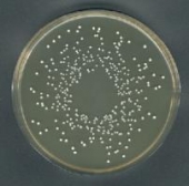 Abb. zeigt Lactobacillus acidophilus auf Rogasa-Agar (aus Merck-Manual)