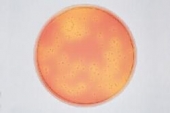 Abb. zeigt S. aureus auf Mannit-Kochsalz-Phenolrot-Agar (aus Merck Manual)