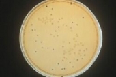 Abb. zeigt Clostridium perfringens (schwarze Kolonien) und Clostridium tetani (aus Merck Manual)