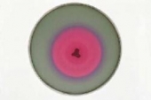 Abb. zeigt eine konzentrisch schwärmende Salmonella typhimurium