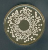 Abb. zeigt Saccharomyces cerevisiae auf Malzextrakt-Agar (aus Merck-Manual)
