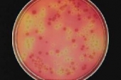 Abb. zeigt Salmonella typhimurium (rot) und E. coli (gelb) auf BPLS, modif. (Edel-Kampelmacher-Medium)