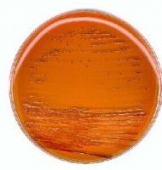 Abb. zeigt Enterococcus faecalis ATCC 19433 auf KF-Streptokokken-Agar (aus Merck-Manual)