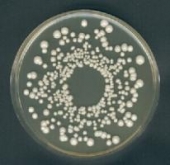 Abb. zeigen Aspergillus niger und Saccharomyces cerevisiae auf YGC-Agar - aus Merck-Manual
