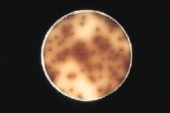 Abb.: L. monocytogenes auf Oxford-Agar (Bild aus Merck Manual)