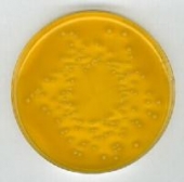 Die Abb. zeigen Salmonella typhimurium ATCC 14028 (rot), und Klebsiella pneumoniae (gelb) - aus Merck-Manual
