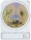 Abb. zeigt schwarze Salmonellenkolonien, die einen Farbumschlag des Nährbodens von violett nach gelb verursacht haben