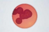 Abb. zeigt Bacillus cereus- und Staphylococcus aureus-Kolonien (2 St.) auf MYP-Agar (aus Merck-Manual)