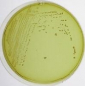 Abb. zeigt Lactobacillus fermentum auf UBA-Nährboden (aus Merck-Manual)