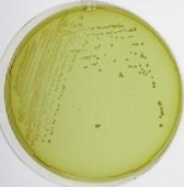 Abb. zeigt Lactobacillus fermentum auf UBA-Nhrboden (aus Merck-Manual)