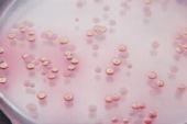 Abb. zeigt E.coli (rot, mit Metallglanz) und Salmonella typhimurium (farblose Kolonien)
