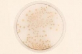Abb. zeigt Pseudomonas aeruginosa auf Cetrimid-Agar (aus Merck-Manual)